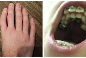 40 невероятных возможностей организма и современной медицины