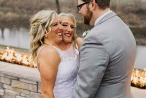 Сиамские близнецы, у которых одно тело на двоих, беременны