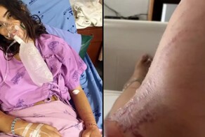 Туристку в Таиланде ужалило самое ядовитое существо на Земле