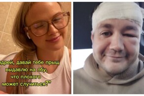 Страшные последствия выдавливания прыщей