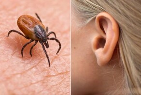 В ухе маленькой девочки поселились сотни клещей