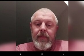 Усыпили собак, откусивших лицо 9-летнему мальчику в Сочи