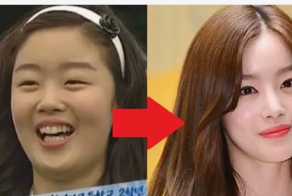 Звезды куплены: невероятный взлет пластики в Корее за счет рекламы от знаменитостей