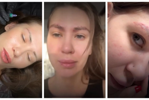 Девушки массово начали вживлять под кожу искусственные брови