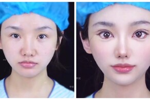 Азиатки начали делать «глаза Барби»