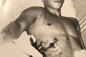 Граната меж ребер