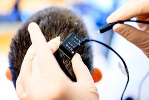 Ученые разработали мозговой имплант, который переводит мысли в речь почти мгновенно