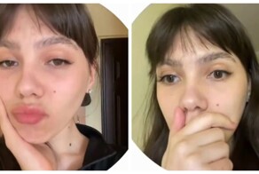 Девушка показала главный страх всех, кто носит брекеты