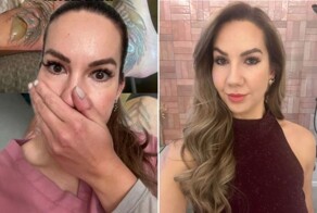 Женщина не могла носить обувь несколько месяцев после неудачного удаления татуировки