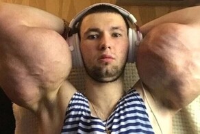 Вазелиновый качок по прозвищу Руки-Базуки попал в больницу