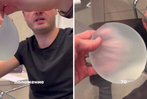 Самые дорогие импланты