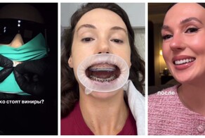 Во сколько обойдется полный комплекс стоматологических услуг с винирами