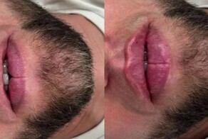 "Куда ваши женщины смотрят!" : на Кавказе мужчины увлеклись увеличением губ и ношением никабов