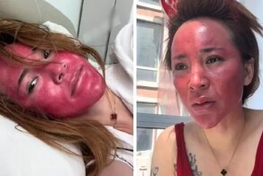 Женщина, 22 года не снимавшая макияж, осталась с красно-фиолетовым лицом