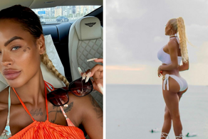 Модель преодолела 5000 миль ради операции на ягодицах, которая в итоге оказалась неудачной