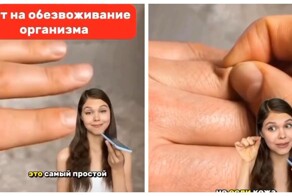 Девушка рассказала про простой тест на обезвоживание