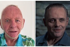 Энтони Хопкинс примерил бандаж для лица, напомнивший пользователям сети маску Ганнибала Лектера