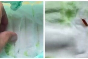 Многодетная мама обнаружила личинок в подгузниках