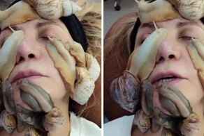 Очередная бьюти-шиза охватила россиянок: ради «вечной молодости» они кладут на лицо гигантских африканских улиток
