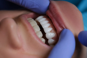 Зубы на клею: как аферистка во Флориде записалась в стоматологи