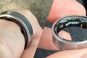 Мужчина чуть не потерял палец из-за умного кольца Samsung