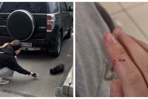 Девушка из Петербурга с трудом получила вакцину после укуса уличного котёнка