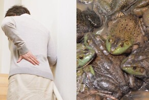 Пенсионерка проглотила восемь живых лягушек в попытке облегчить боль в спине