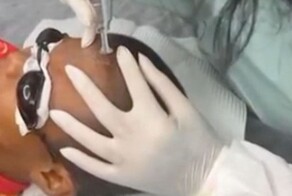 Хулиганы сделали оскорбительную татуировку на лбу мальчика