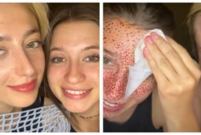 В погоне за естественной красотой: девушки нарисовали веснушки и пожалели