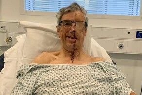 Пострадавшему в&nbsp;аварии британцу напечатали лицо на&nbsp;3D-принтере