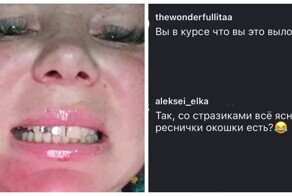 Когда денег на виниры нет, но блестеть хочется