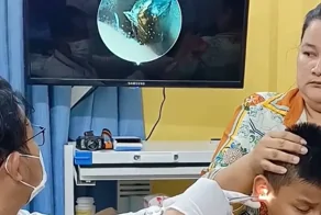 В Камбодже у подростка в ухе обнаружили живого таракана