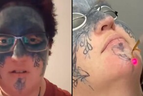 Женщина сводит с лица насильно нанесённые татуировки