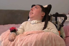 Родившейся без мозга девушке исполнилось 20 лет