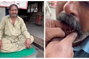 Шокирующая стоматологическая практика в Пакистане