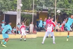 Жёсткий момент на матче: футболист случайно встретил бутсой лицо соперника