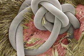 25 примеров того, как неожиданно выглядят под микроскопом привычные вещи