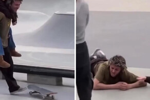 В США парень остался без зубов, пытаясь эффектно прокатиться на скейте с девушкой