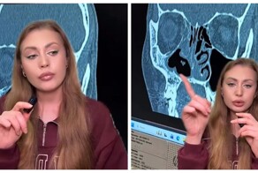 Вредная привычка обернулась для москвички провалившимся носом