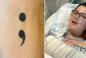 После операции девушка обнаружила татуировку с левой руки на языке