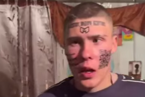 Парню, который сделал тату, чтобы получить квартиру от Меллстроя, приходится сводить рисунки с лица