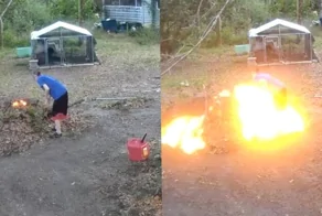 Женщина нашла самый радикальный способ удаления волос