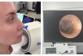 Муравей забрался в ухо спящей женщине