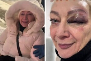 Спуск с горки на ватрушке закончился травмпунктом