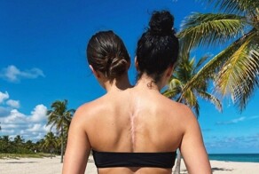 Две головы, один сервер и пустые кошельки фанатов: феномен Валерии и Камилы