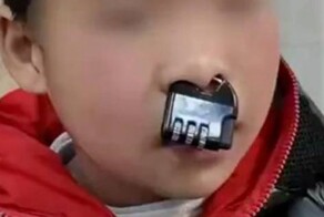 Ребёнок застрял с кодовым замком в носу