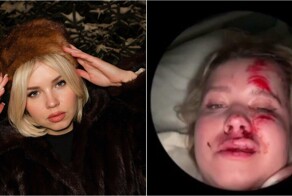 Москвичка въехала в дерево на тюбинге и чудом осталась жива