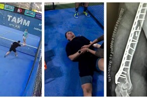 Парень получил сложный перелом руки, играя в падел