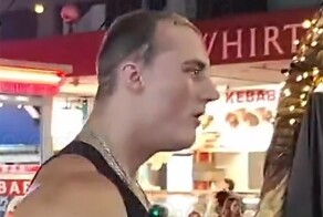 Стример потерял лицо и волосы в прямом эфире разрушив миф об идеальной внешности за одну секунду