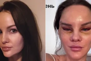 Ожидание и реальность: история одной операции